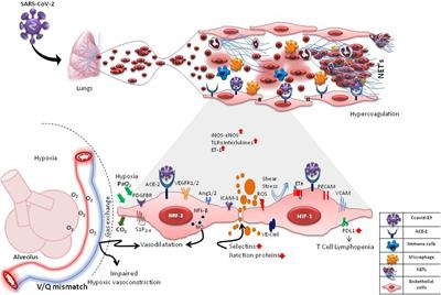 The Enigma of Endothelium in COVID-19